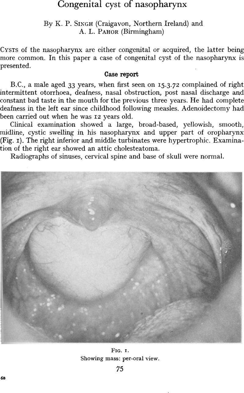 Congenital Cyst Of Nasopharynx The Journal Of Laryngology Otology