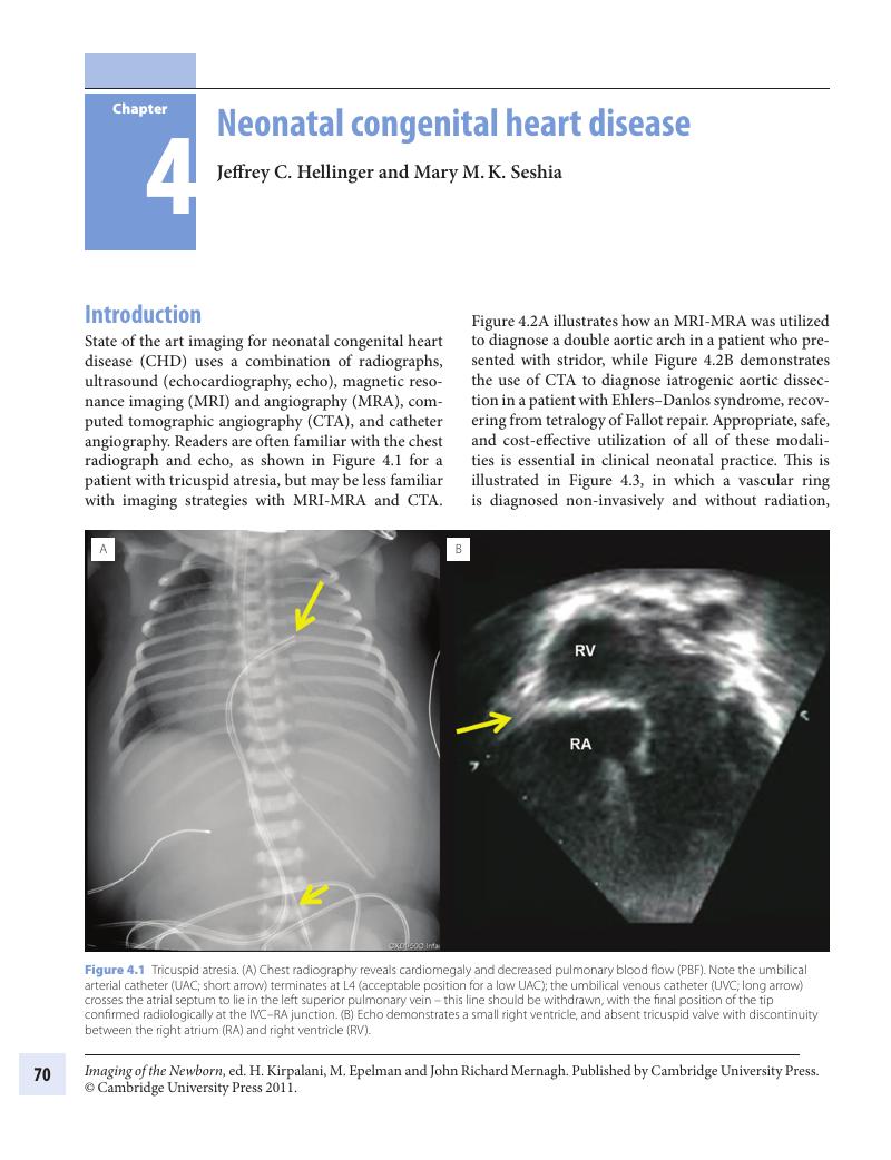 Neonatal Congenital Heart Disease Chapter 4 Imaging Of The Newborn