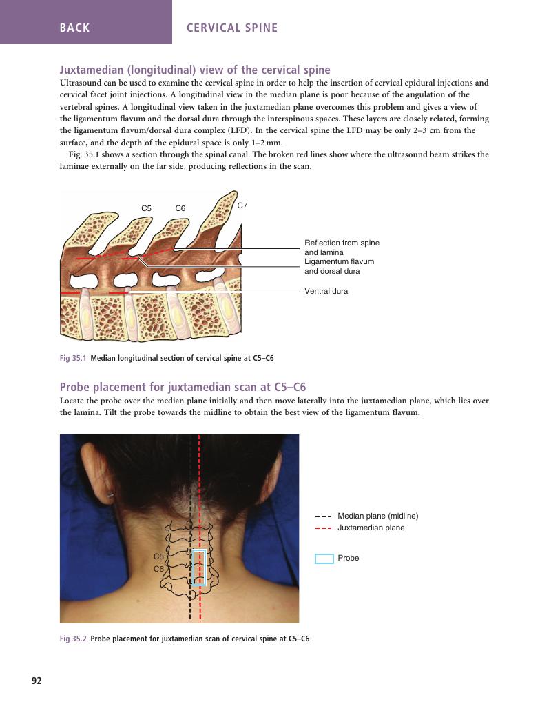 Cervical Spine Sonoanatomy For Anaesthetists