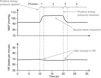 examples of valsalva maneuver