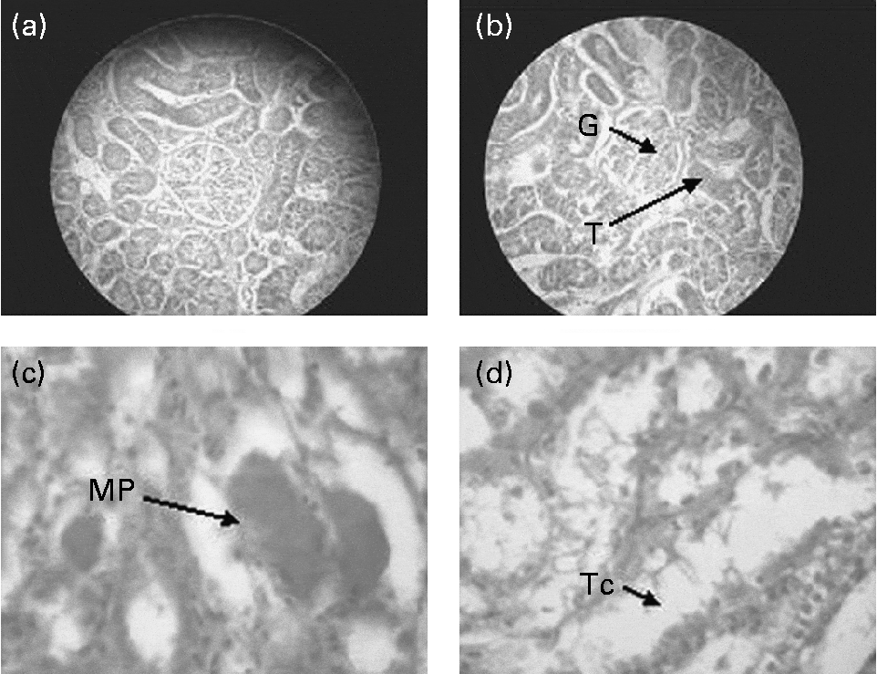Amelioration of hyperglycaemia and its associated complications by
