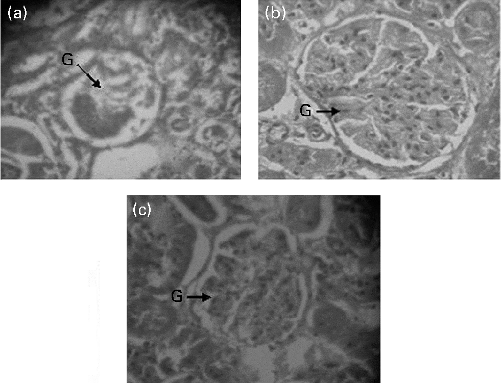 Amelioration of hyperglycaemia and its associated complications by
