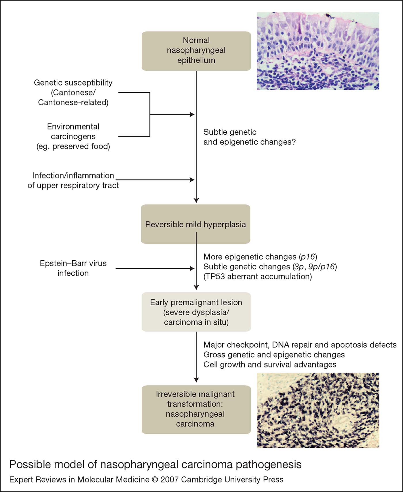 Nasopharyngeal carcinoma: molecular pathogenesis and therapeutic ...