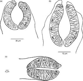 fasciola hepatica miracidia