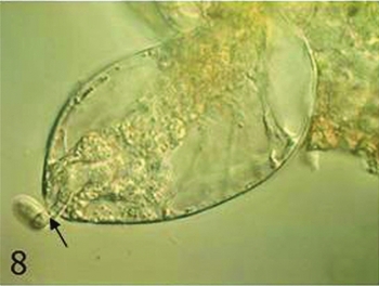 PDF) Transcriptomics of manually isolated Amborella trichopoda egg