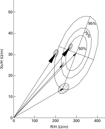 Segmental Bioelectrical Impedance Spectroscopy to Monitor Fluid