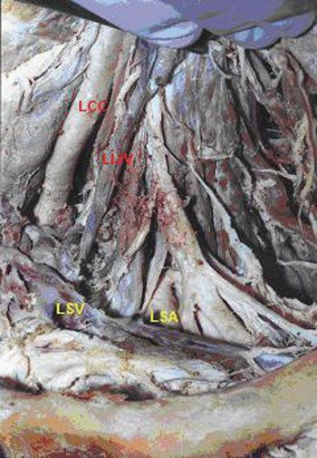 external jugular vein cadaver
