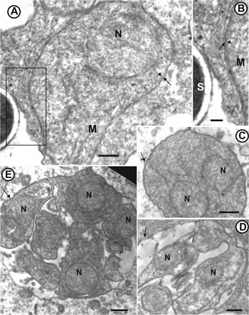 Brine Shrimp (Artemia salina) - Digestive System Phyla