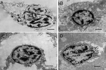 Morphological characterization of the haemocytes of the ivory