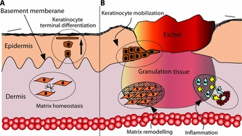 Delayed wound healing in elderly people Reviews in Clinical