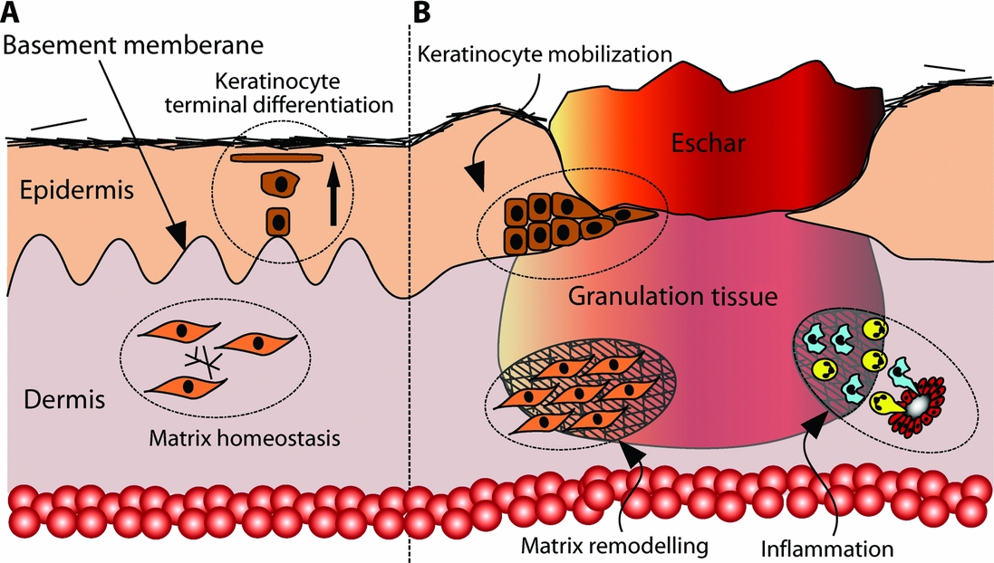 Delayed wound healing in elderly people | Reviews in Clinical ...