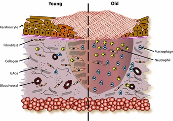 Delayed wound healing in elderly people | Reviews in Clinical ...