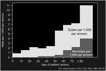 Patient Suffers from Post-herpetic Neuralgia, Pain Following Shingles, for  25 Years After Missing the Optimal Period for Treatment - FV Hospital