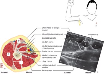 The upper limb (Chapter 6) - Applied Anatomy for Anaesthesia and