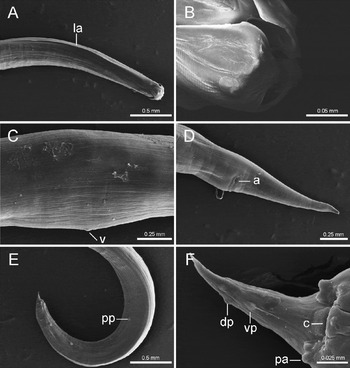 Morphological and molecular characterization of Ortleppascaris sinensis ...