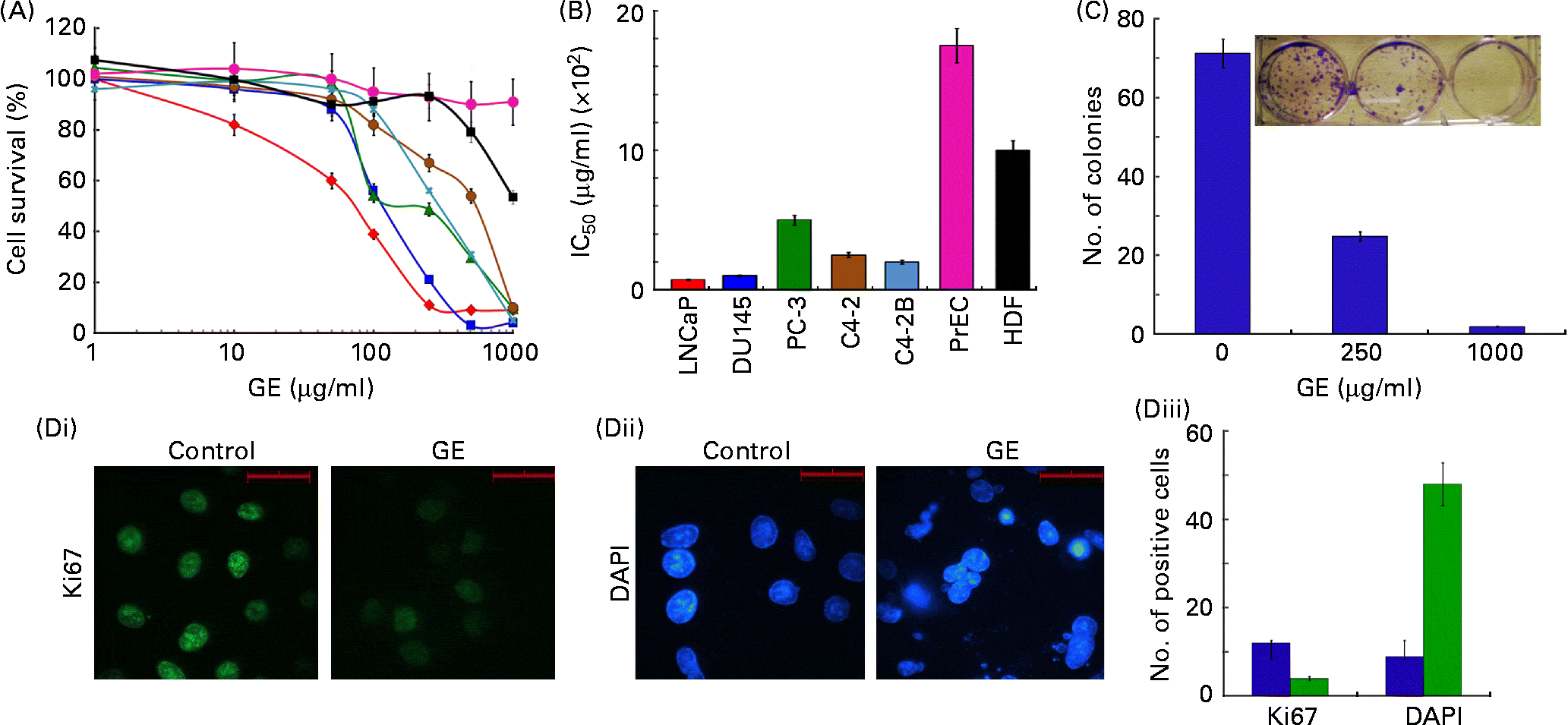 Benefits of whole ginger extract in prostate cancer British Journal
