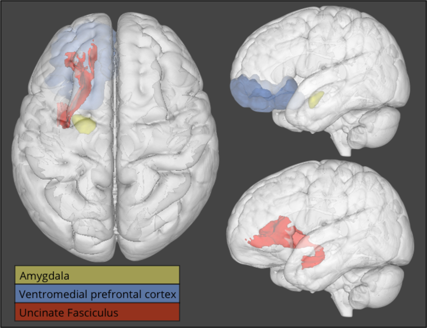 Lower Structural Integrity Of The Uncinate Fasciculus Is Associated