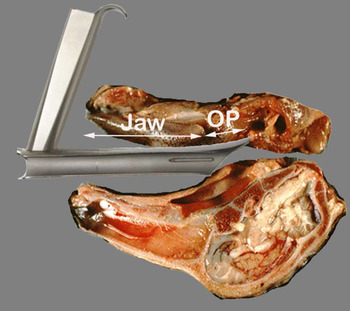 New-Med Parsons Operating Laryngoscope