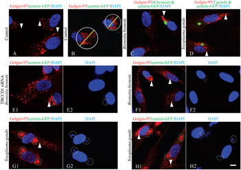 The G2 phase controls binary division of Toxoplasma gondii