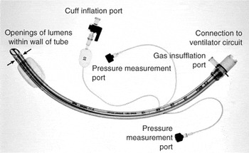 Effect of catheter design on tracheal pressures during tracheal gas ...