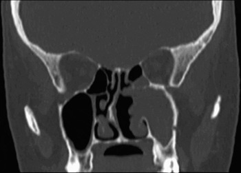 Computed tomography and/or magnetic resonance imaging for pre-operative ...