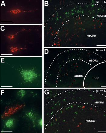 代引き人気 the of nucleus the of Projections basal in root optic その他