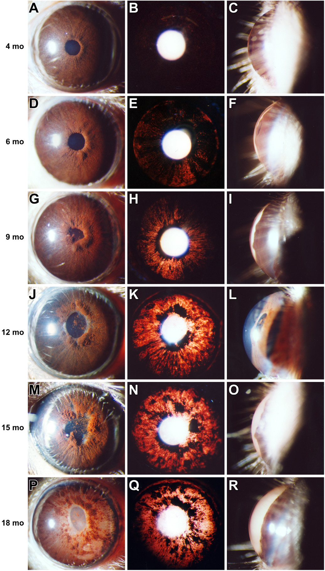 Inherited glaucoma in DBA/2J mice: Pertinent disease features for