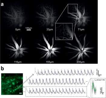 Optogenetics In Vision Restoration And Memory Part V Optogenetics - bypassed roblox ids inna