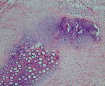 Differentiation of adipose-derived stem cells into ear auricle ...