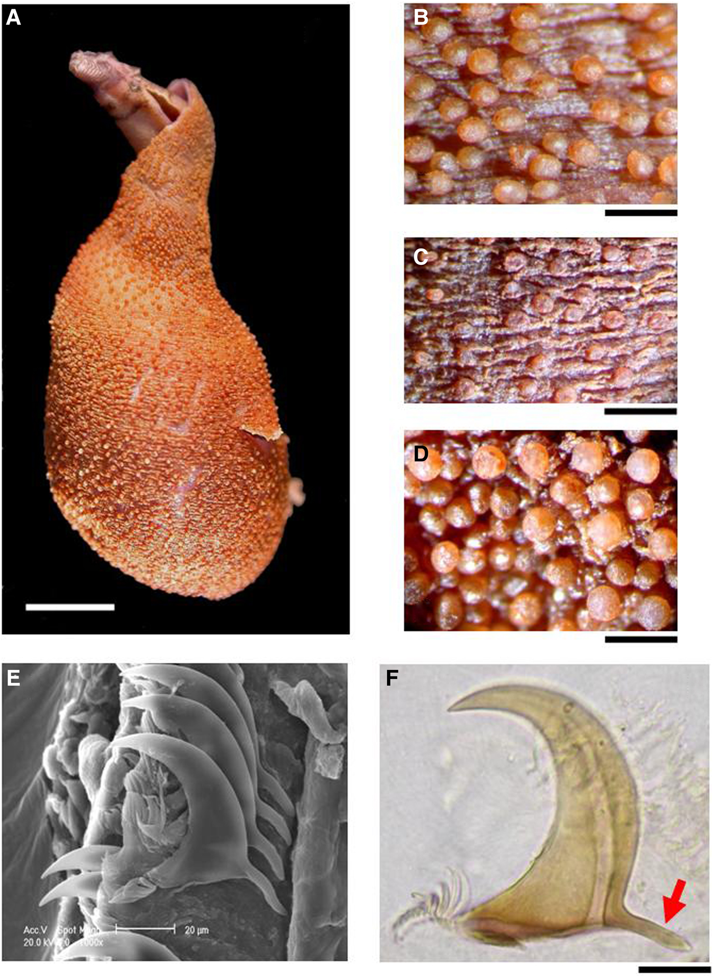 New records of Phascolosoma turnerae (Sipuncula Phascolosomatidae