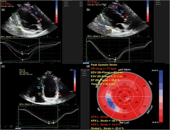 Does layer-specific strain using speckle tracking echocardiography improve  the assessment of left ventricular myocardial deformation? A review -  ScienceDirect