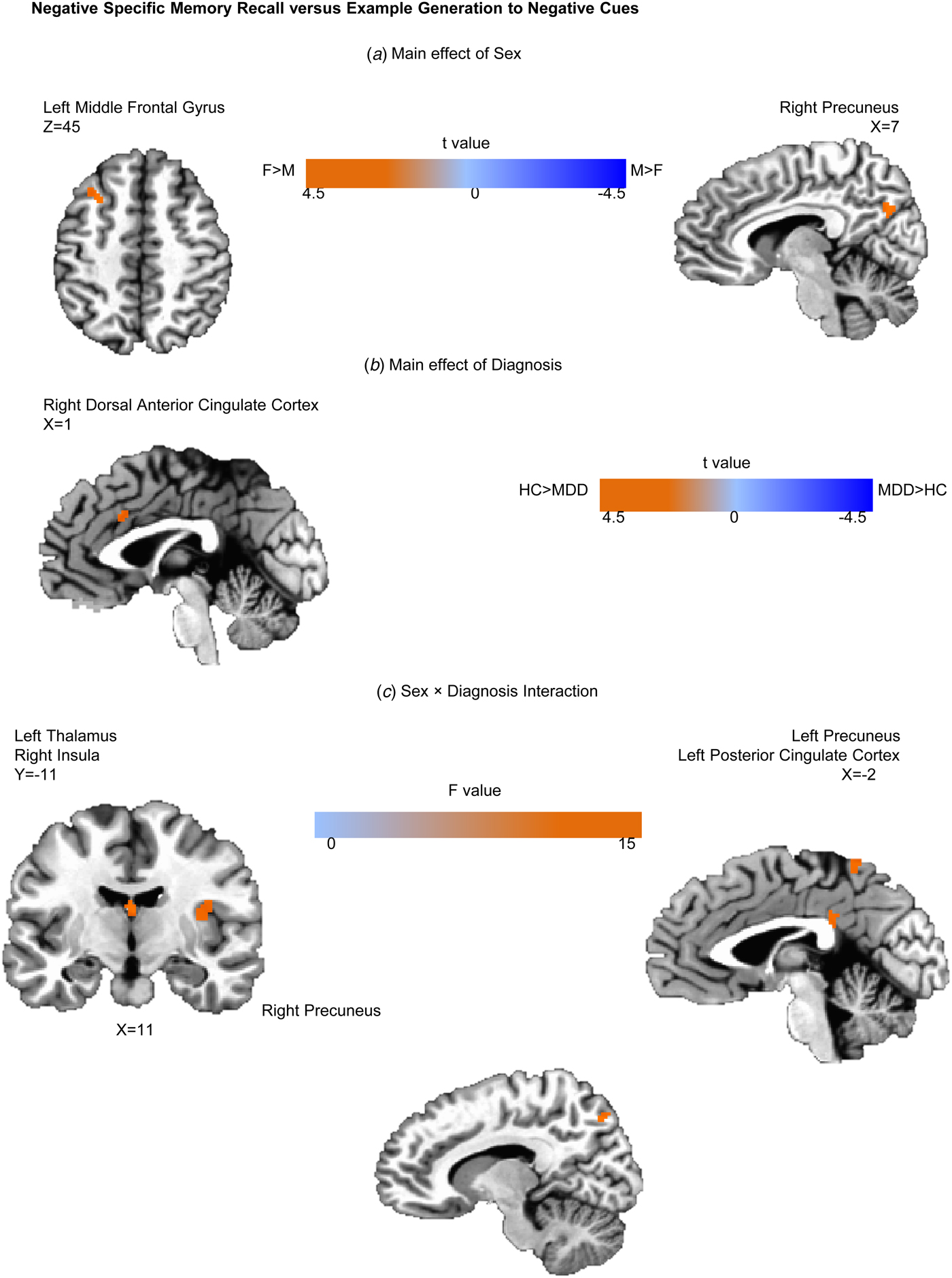 Functional Neuroimaging Of Sex Differences In Autobiographical Memory Free Download Nude Photo