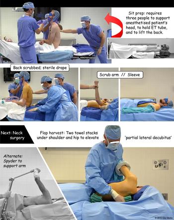 The procedure of using TSCLB. (A) Before delivery, placing hip pads