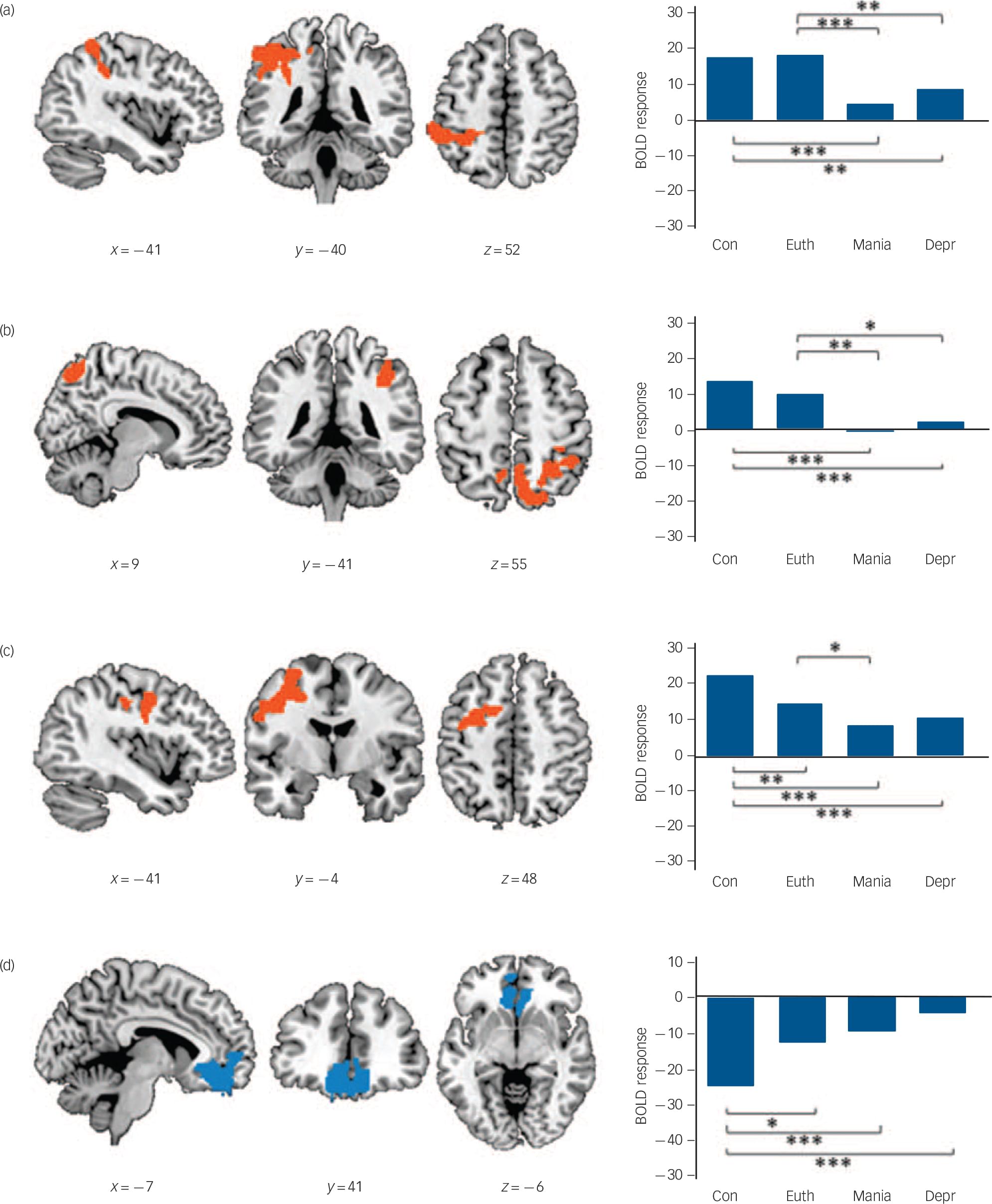 Brain functional changes across the different phases of bipolardisorder ...