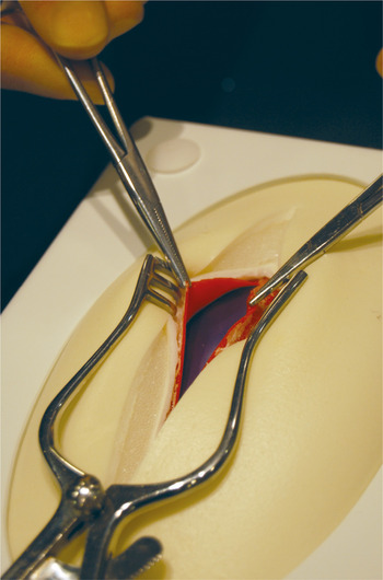 Basic open general surgical techniques (Module 1) - Basic