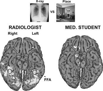 Studies of the Activation and Structural Changes of the Brain
