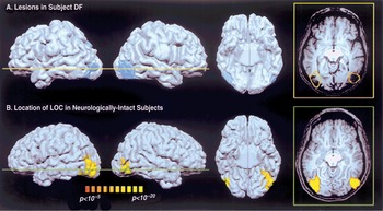 Occipital and Parietal Lobes Chapter 4 The Brain and Behavior