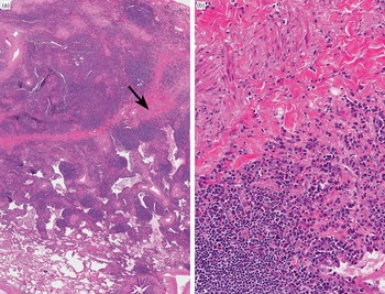 Diagnostic Atlas of Non-Neoplastic Lung Disease: A Practical