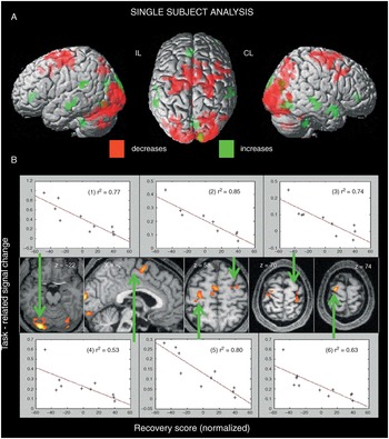 Functional electrical stimulation in neurorehabilitation (Chapter 12) -  Textbook of Neural Repair and Rehabilitation