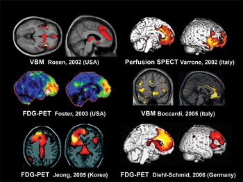 国産品 (Chapter dementia in Neuroimaging 3) Behavioral The - スポーツトイ・アクショントイ