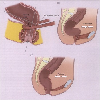 Common Anorectal Problems | GLOWM