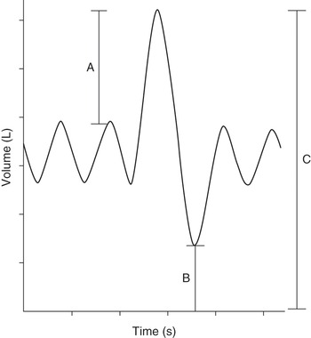 Blood pressure measurement - OSCE guide 