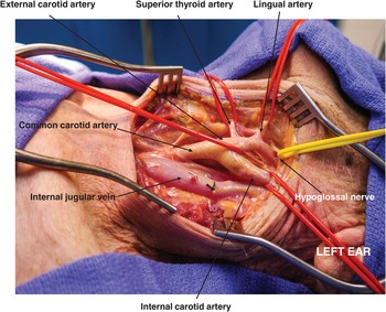 internal jugular vein