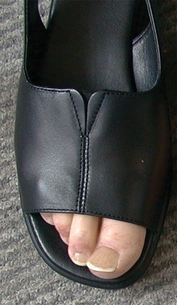 shoe toe fillers for amputee inside of shoe