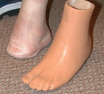 prosthetic toe filler
