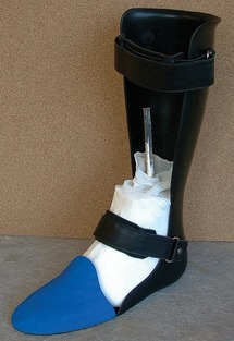 prosthetic toe filler