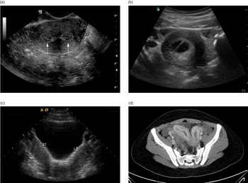 Pelvic: gynecology (Chapter 14) - Pediatric Emergency Critical