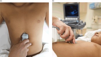 Salus sonography - ⚜️eFAST - Extended focused assessment with sonography in  trauma⚜️ . ▶️The term FAST was first coined by Rozycki and co-workers in  1995 and is the most widely accepted acronym