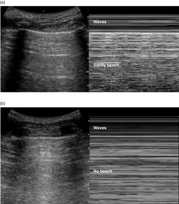 Diagnostic ultrasound (Section 2) - Pediatric Emergency Critical 