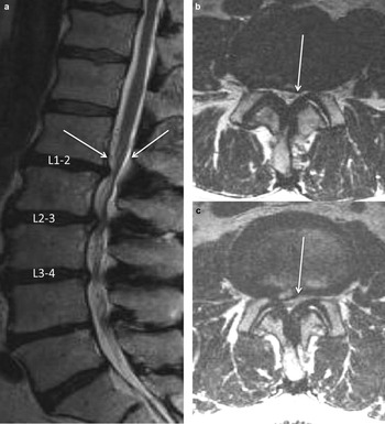 Bladder bowel and sexual dysfunction Chapter 16 Imaging